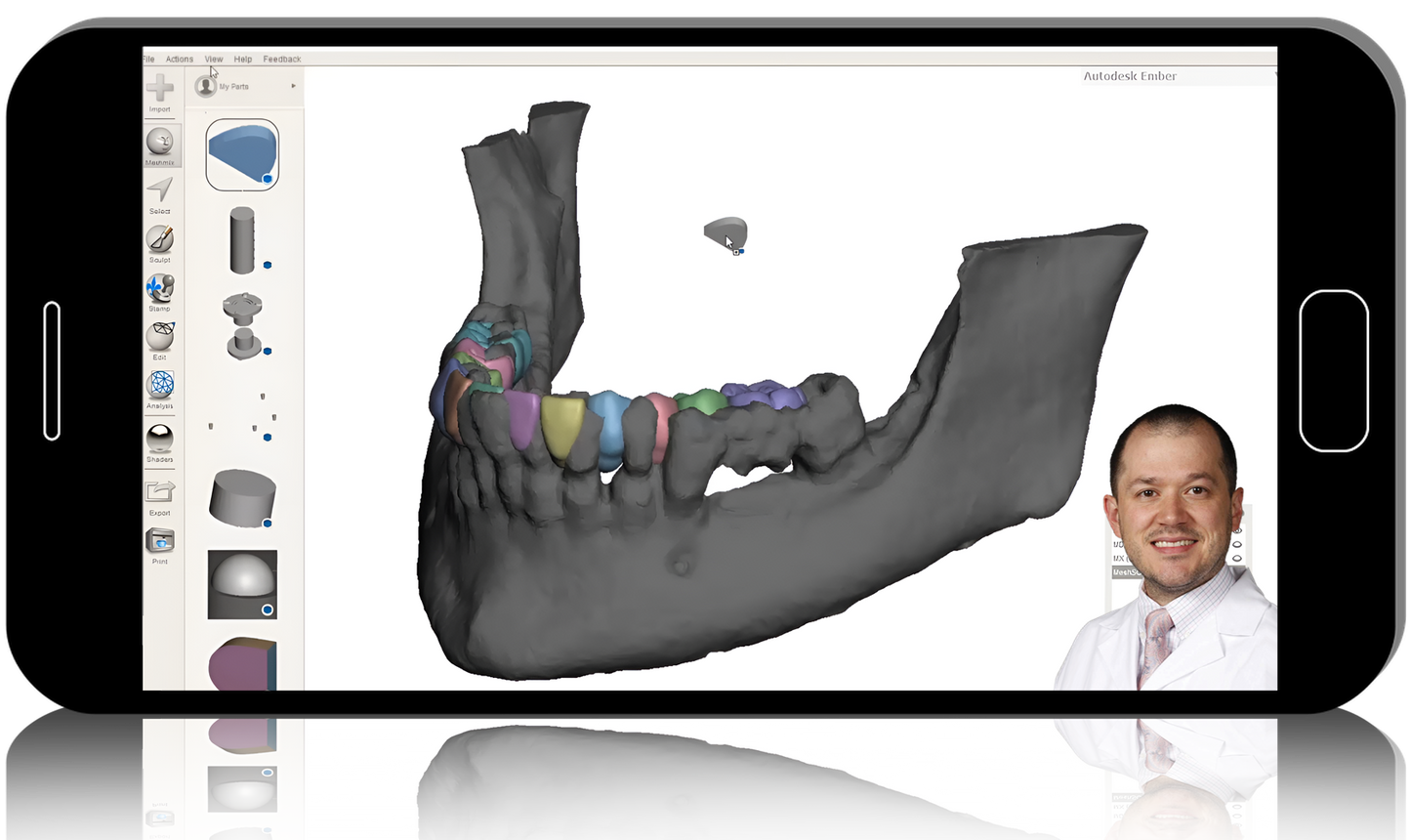 Advanced Implant Planning