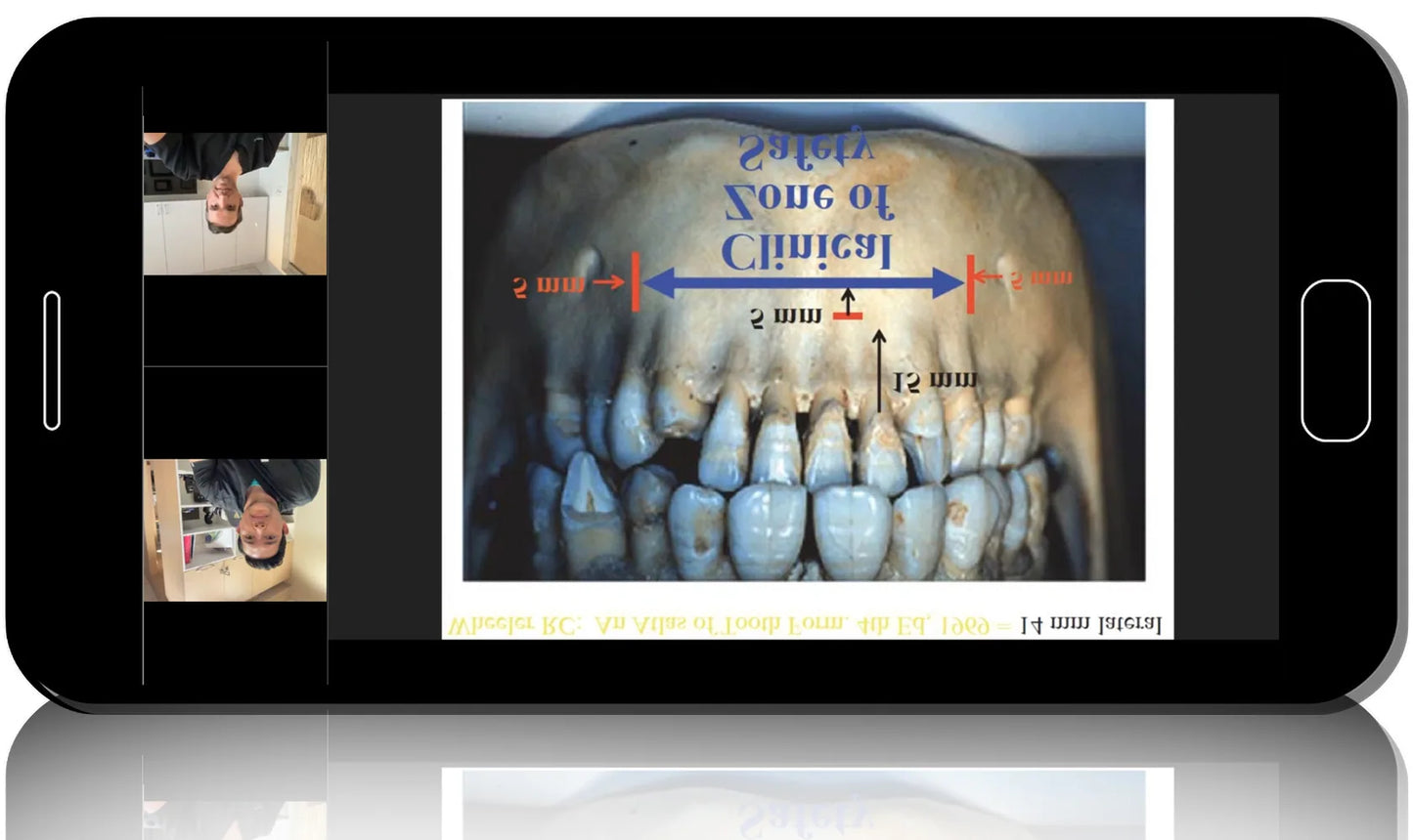 The Complete Digital Implant Workflow Series