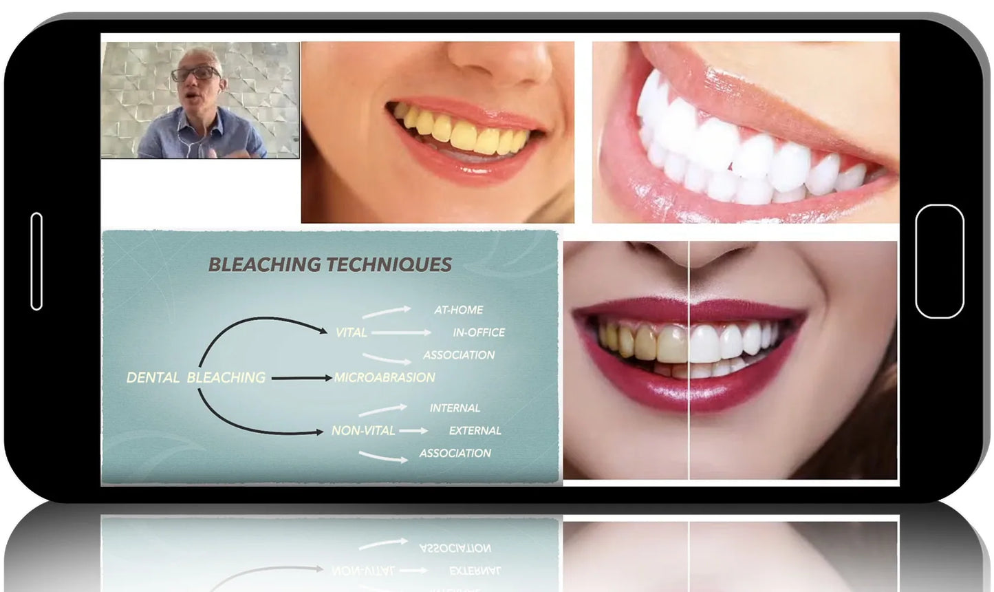 Dental bleaching: the science-based techniques for every day