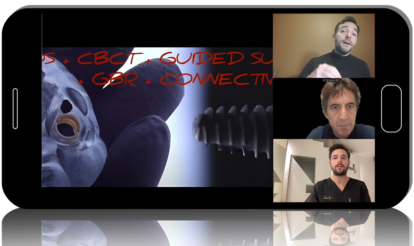 Library of Oral Surgery. Module 2: Soft Tissue Management and Implantation in the Aesthetic Zone