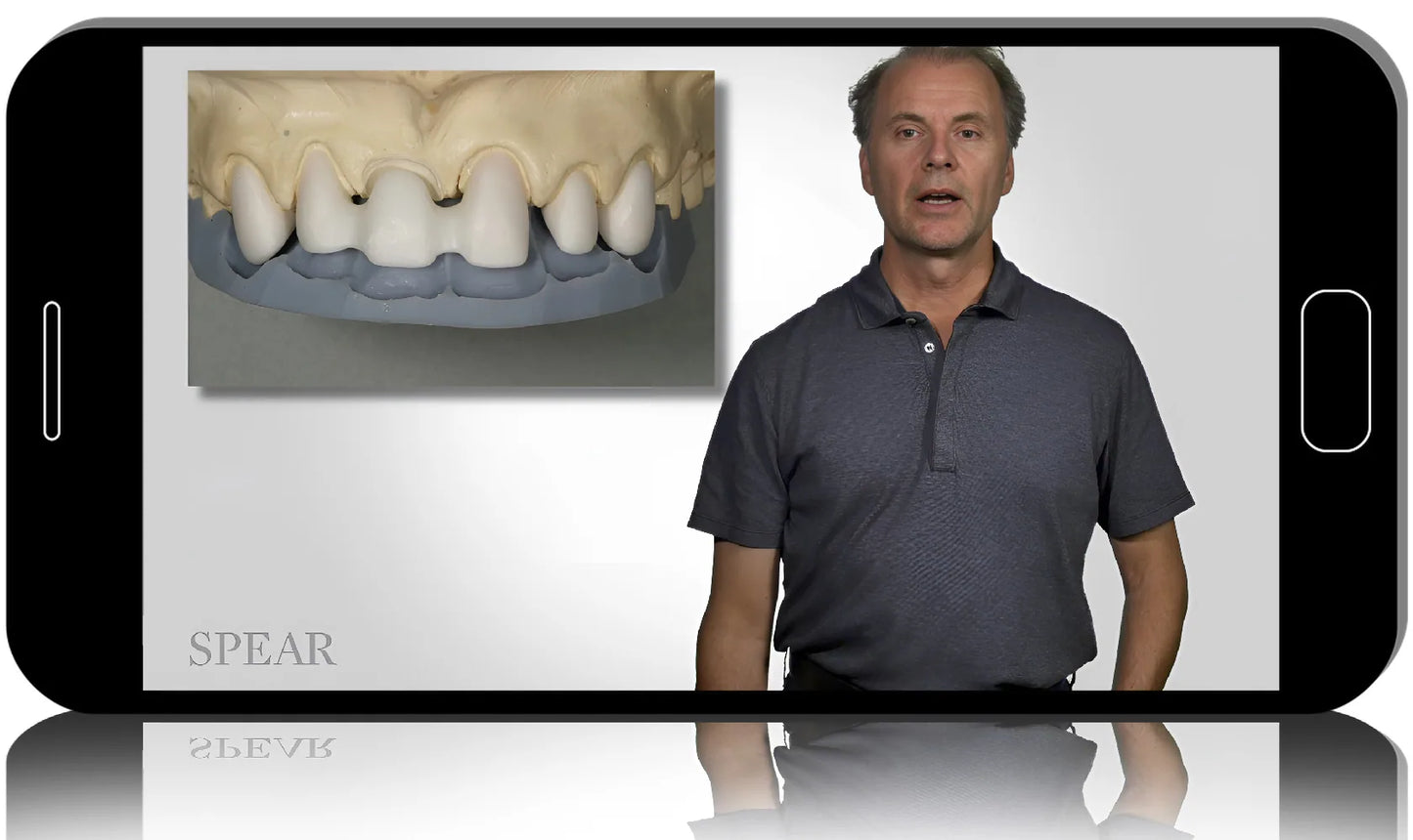 Digital Dentistry: From Polishing to Thermoplastics