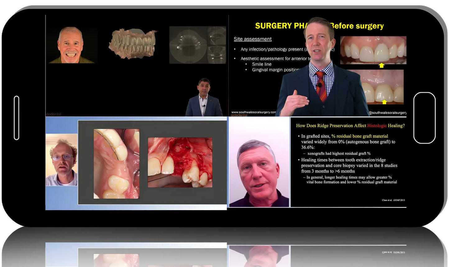 Digital Implantology and more Updated in Dentistry Techniques
