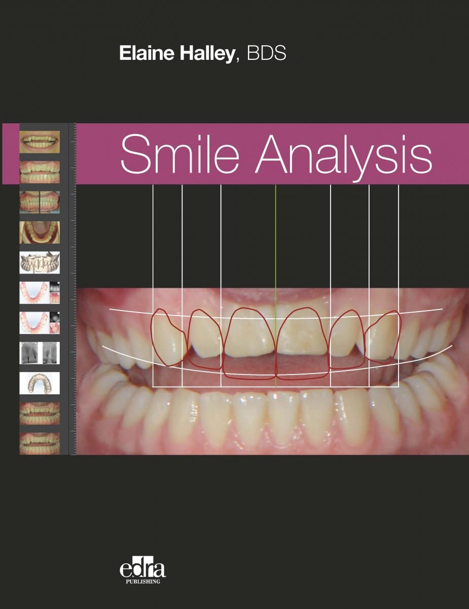 SMILE ANALYSIS (Elaine Halley)