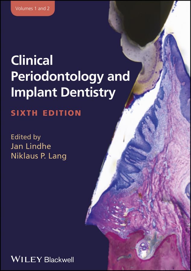Clinical Periodontology and Implant Dentistry 6th Edition, Volume 1