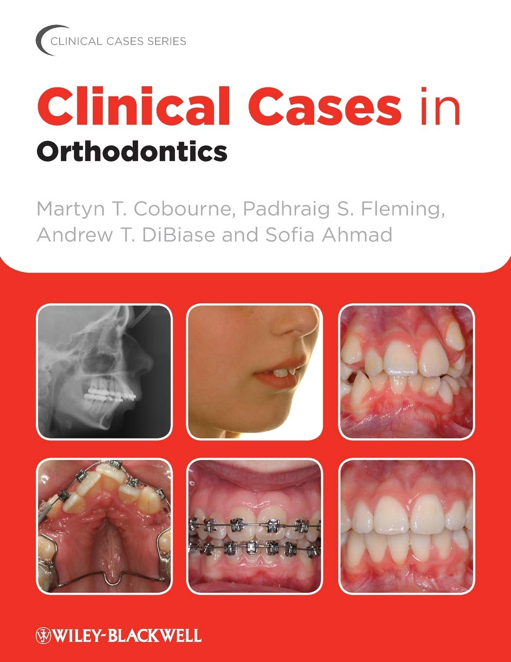 Clinical Cases in Orthodontics 1st Edition