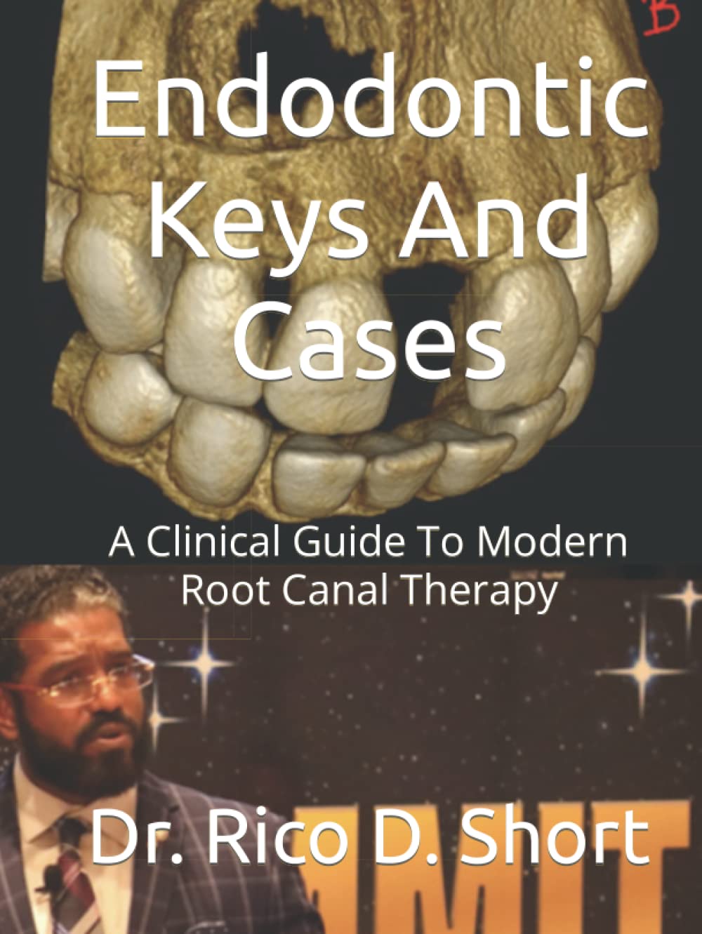 Endodontic Keys And Cases: A Clinical Guide To Modern Root Canal Therapy