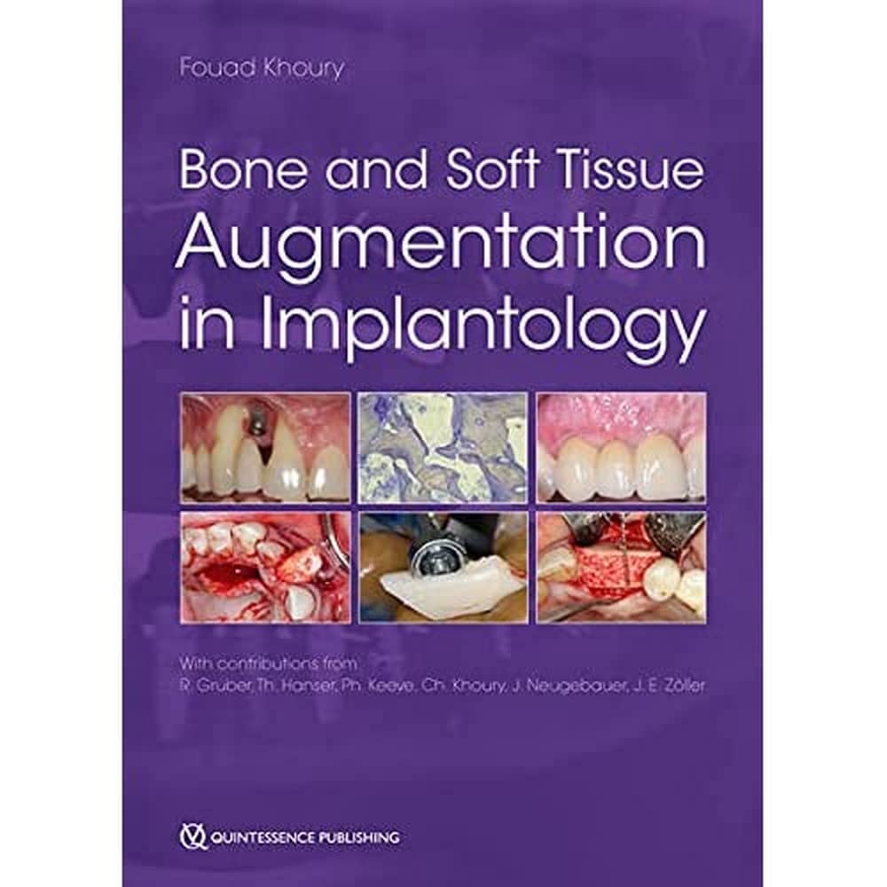 Bone and Soft Tissue Augmentation in Implantology 1st Edition