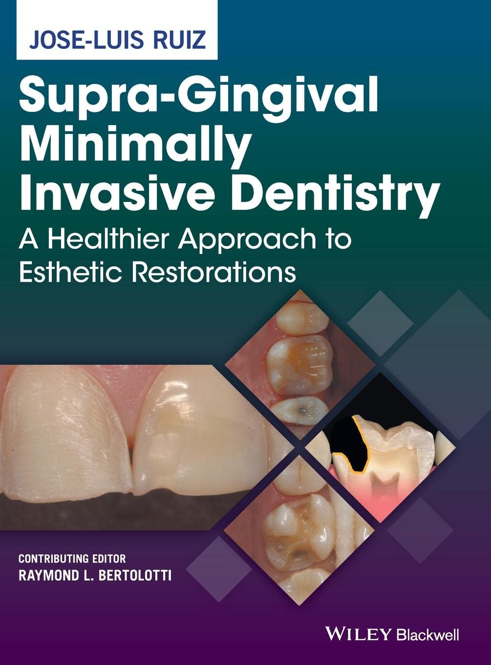 Supra-Gingival Minimally Invasive Dentistry 1st Edition