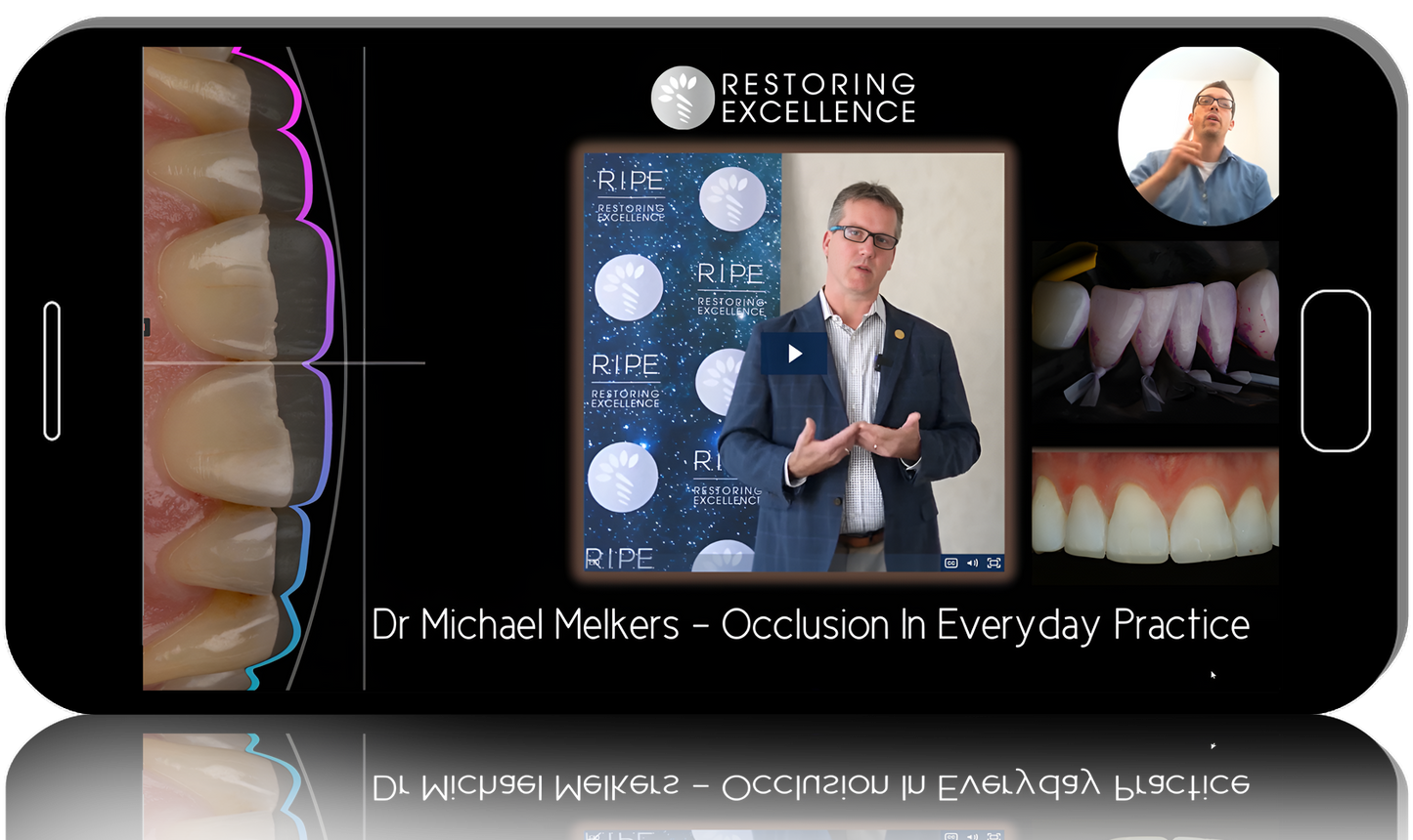 RipeGlobal A Simplified Approach to Advanced Composite Techniques