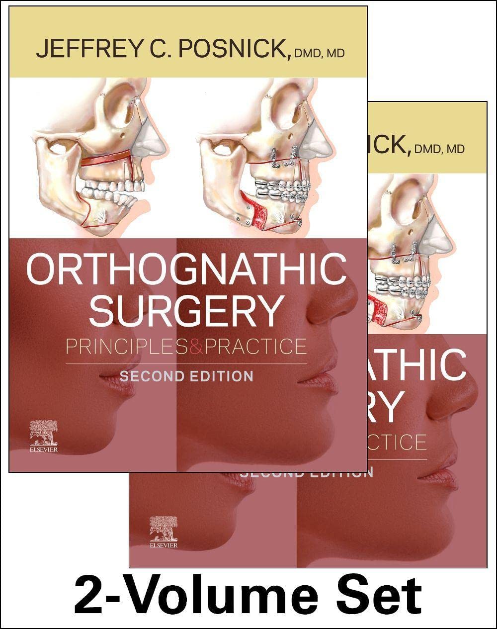 Orthognathic Surgery - 2 Volume Set: Principles and Practice 2nd Edition