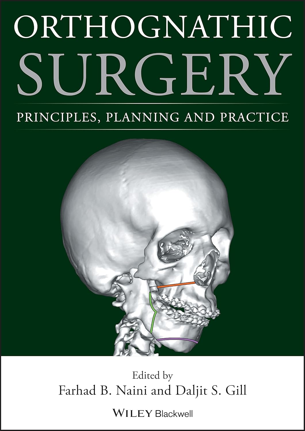 Orthognathic Surgery: Principles, Planning and Practice 1st Edition