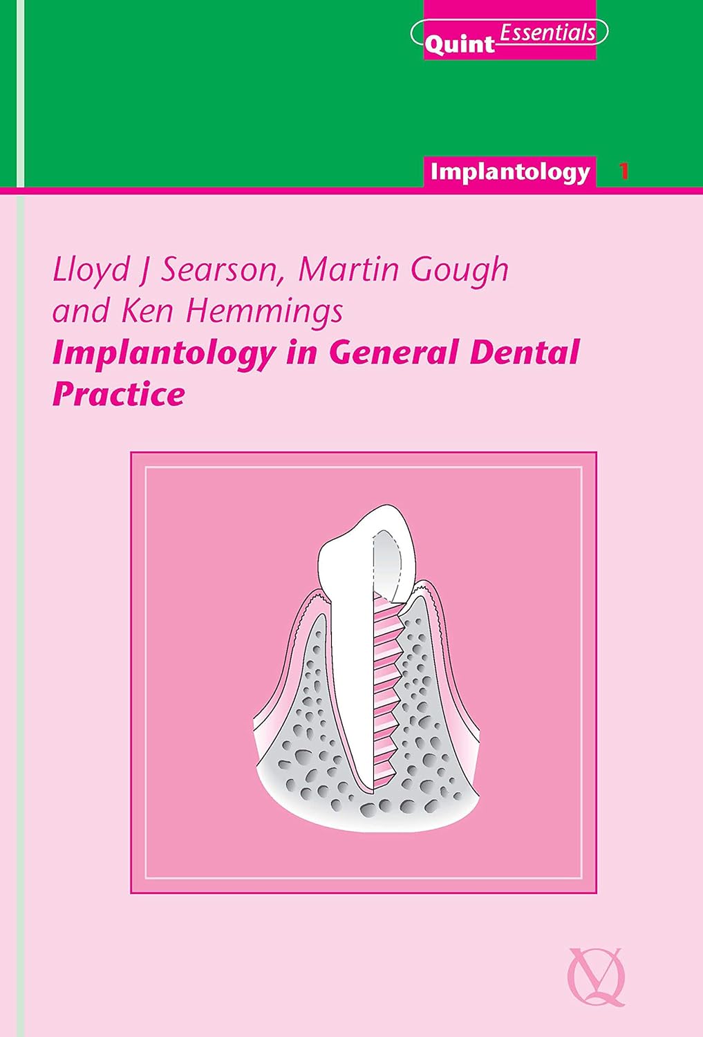 Implantology in General Dental Practice (QuintEssentials of Dental Practice Book 4)