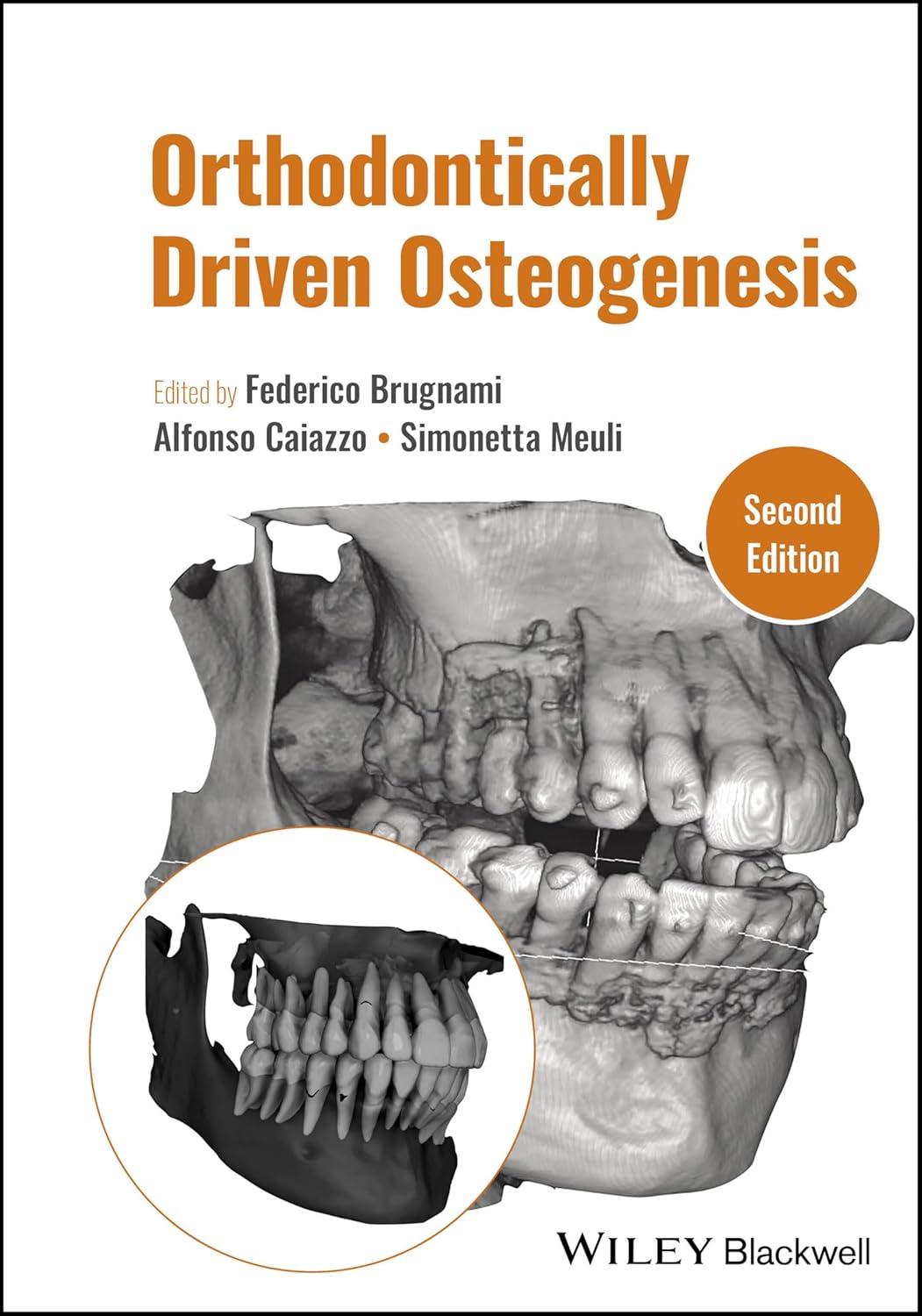 Orthodontically Driven Osteogenesis 2nd Edition