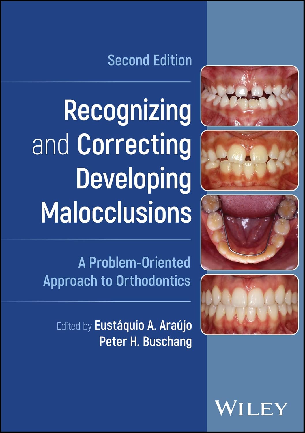 Recognizing and Correcting Developing Malocclusions: A Problem‐Oriented Approach to Orthodontics, 2nd Edition