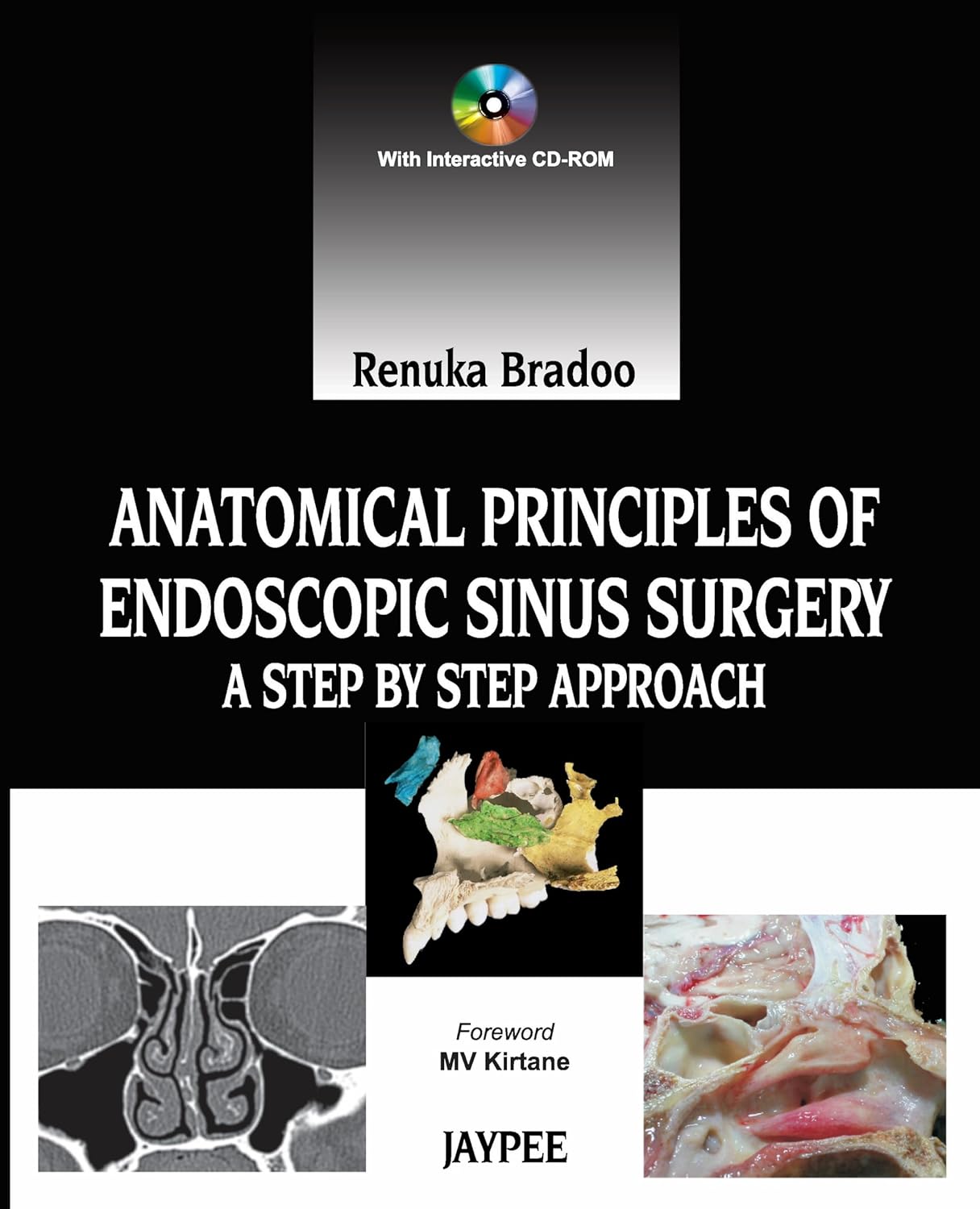 Anatomical Principles of Endoscopic Sinus Surgery