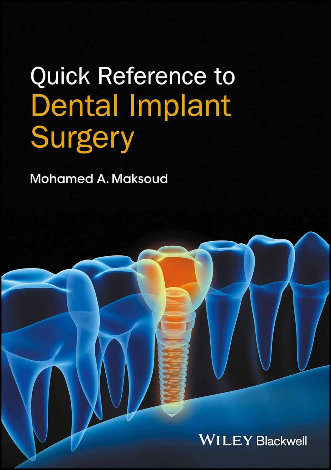 Quick Reference to Dental Implant Surgery 1st Edition
