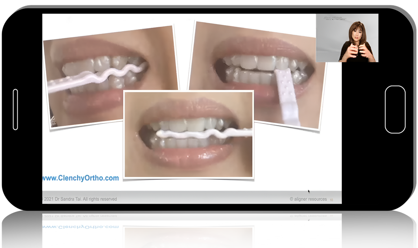 Online clear aligner training from a leading global expert