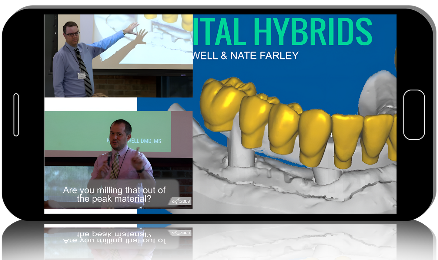 Digital Hybrids for Dentists & Technicians