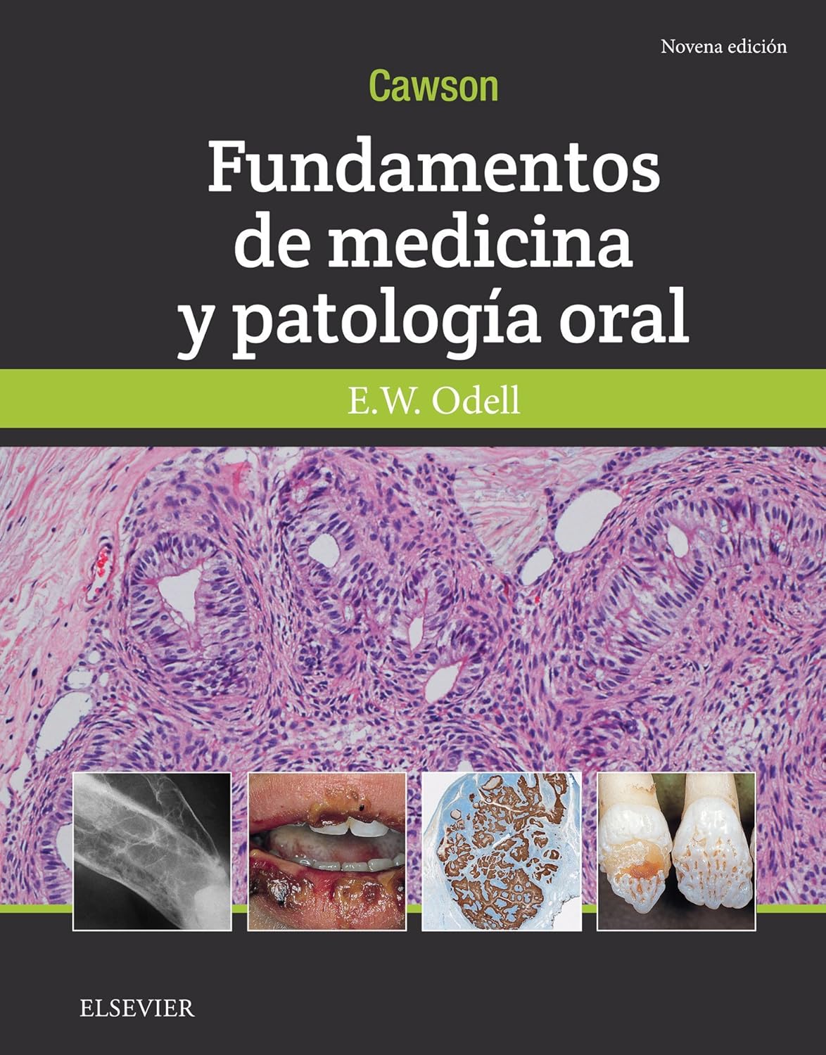 Cawson. Fundamentos de medicina y patología oral - 9ª edición -2018