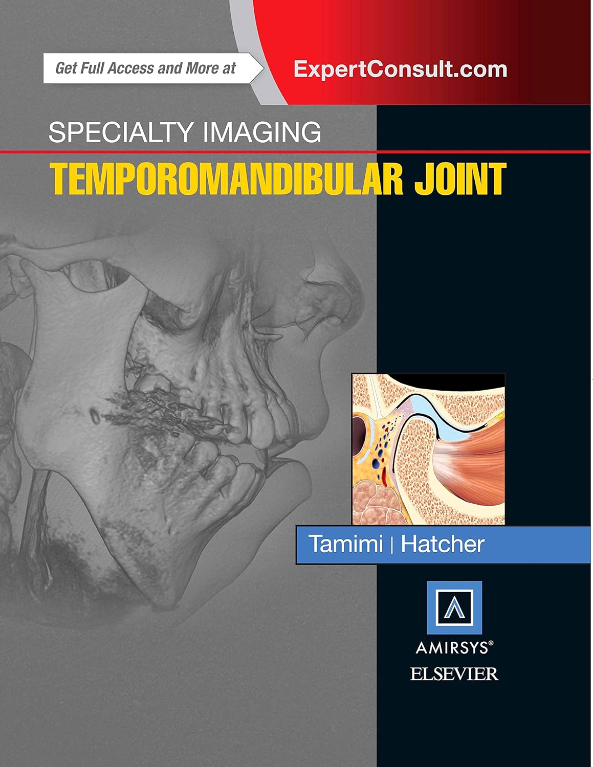 Specialty Imaging: Temporomandibular Joint 1st Edition
