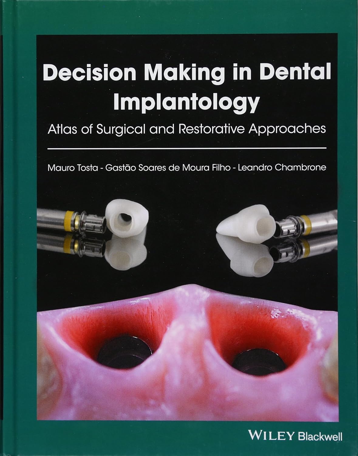 Decision Making in Dental Implantology: Atlas of Surgical and Restorative Approaches 1st Edition