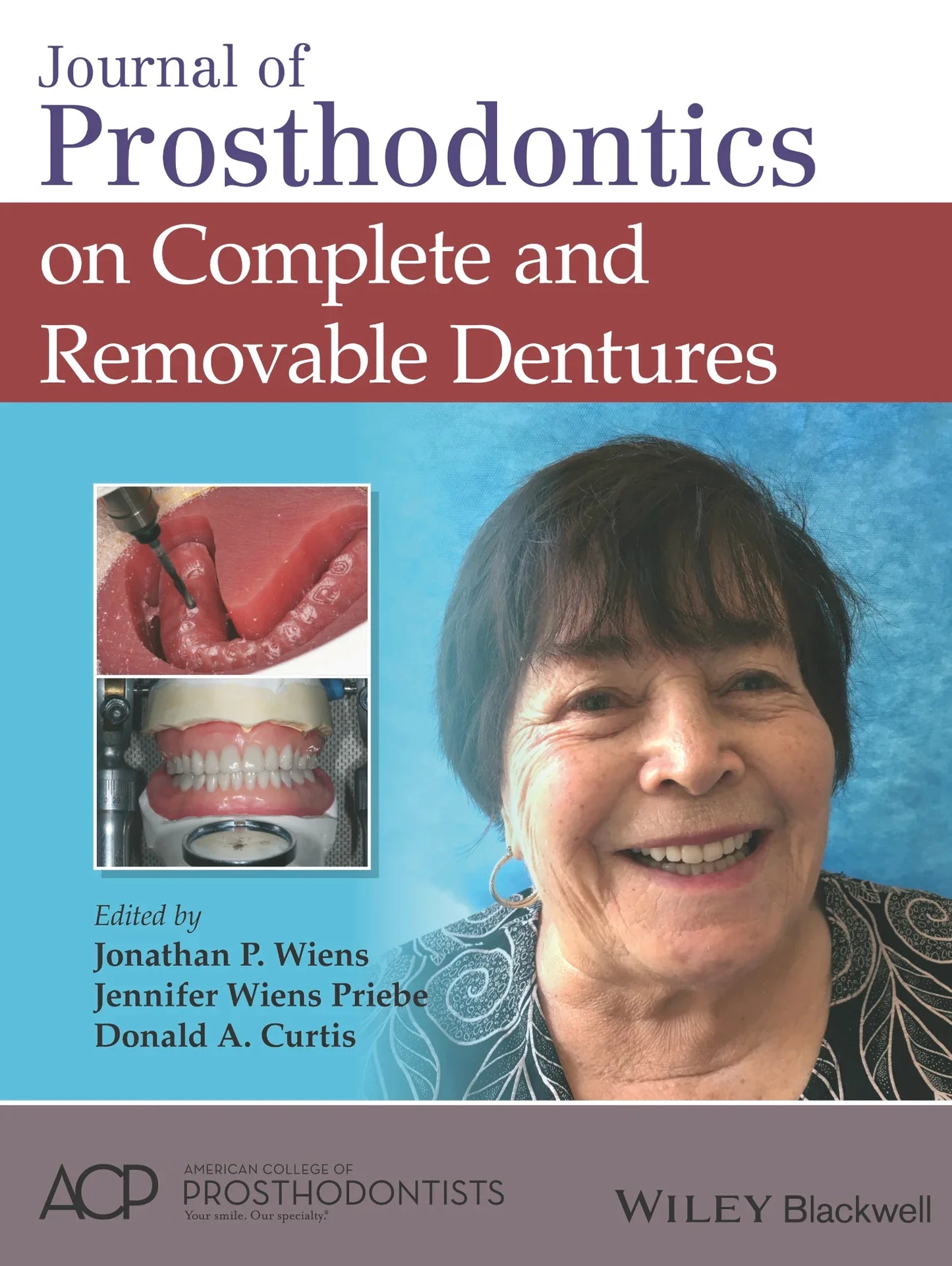 Journal of Prosthodontics on Complete and Removable Dentures 1st Edition