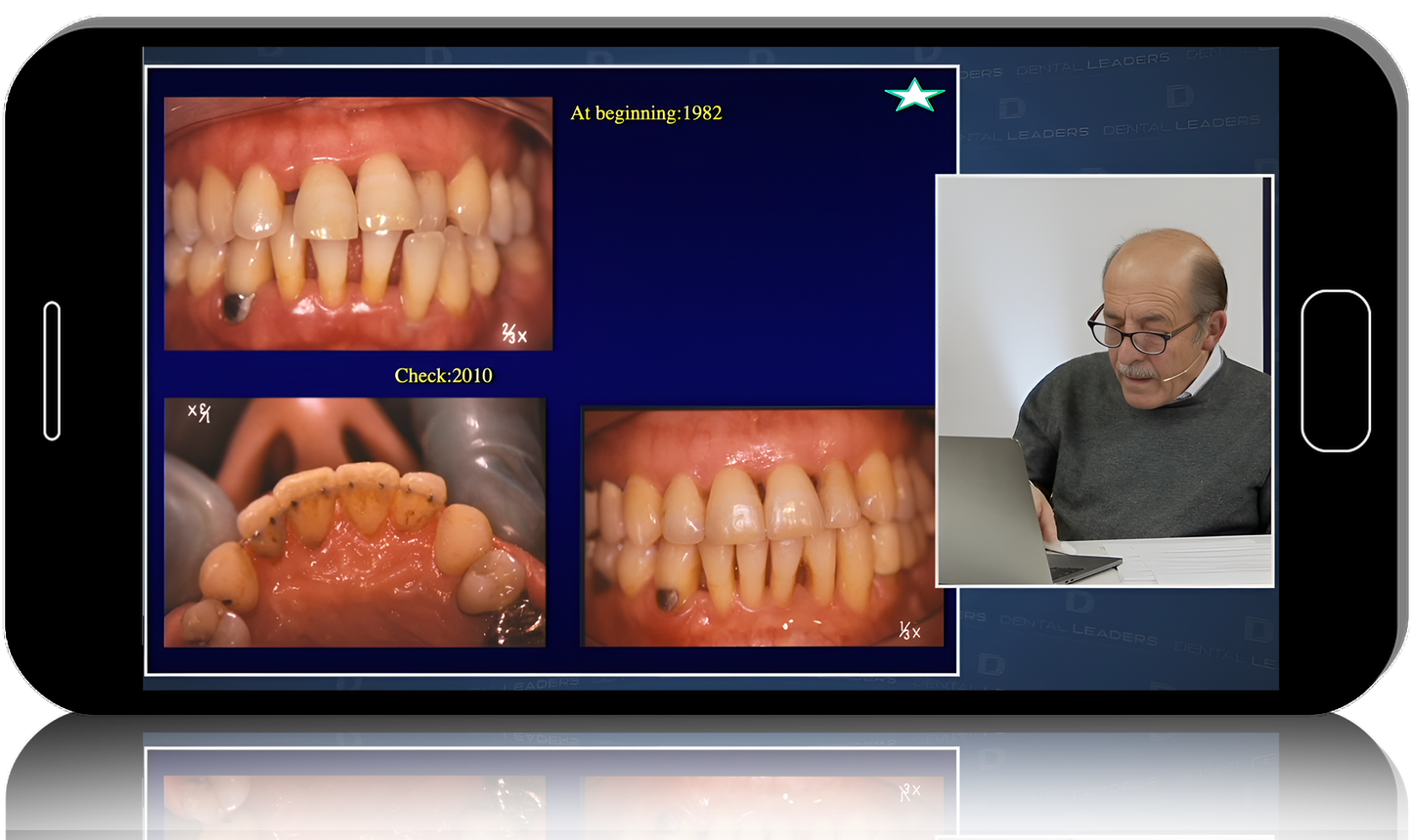 NYU & DentalLeaders Current Concepts in American Dentistry: Perio MasterClass Surgical