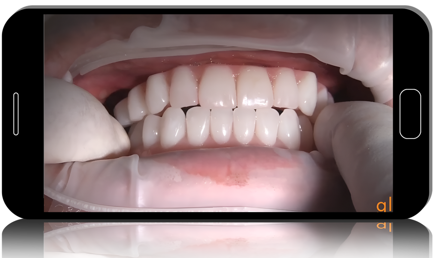 Online Residency Program A-Z in Implant Dentistry