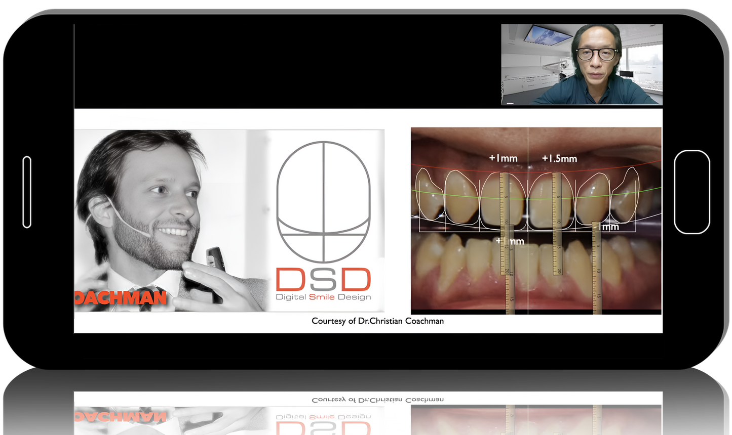 Digital Aesthetic Functional Rehabilitation: Prosthetics, Implantation, Orthodontics