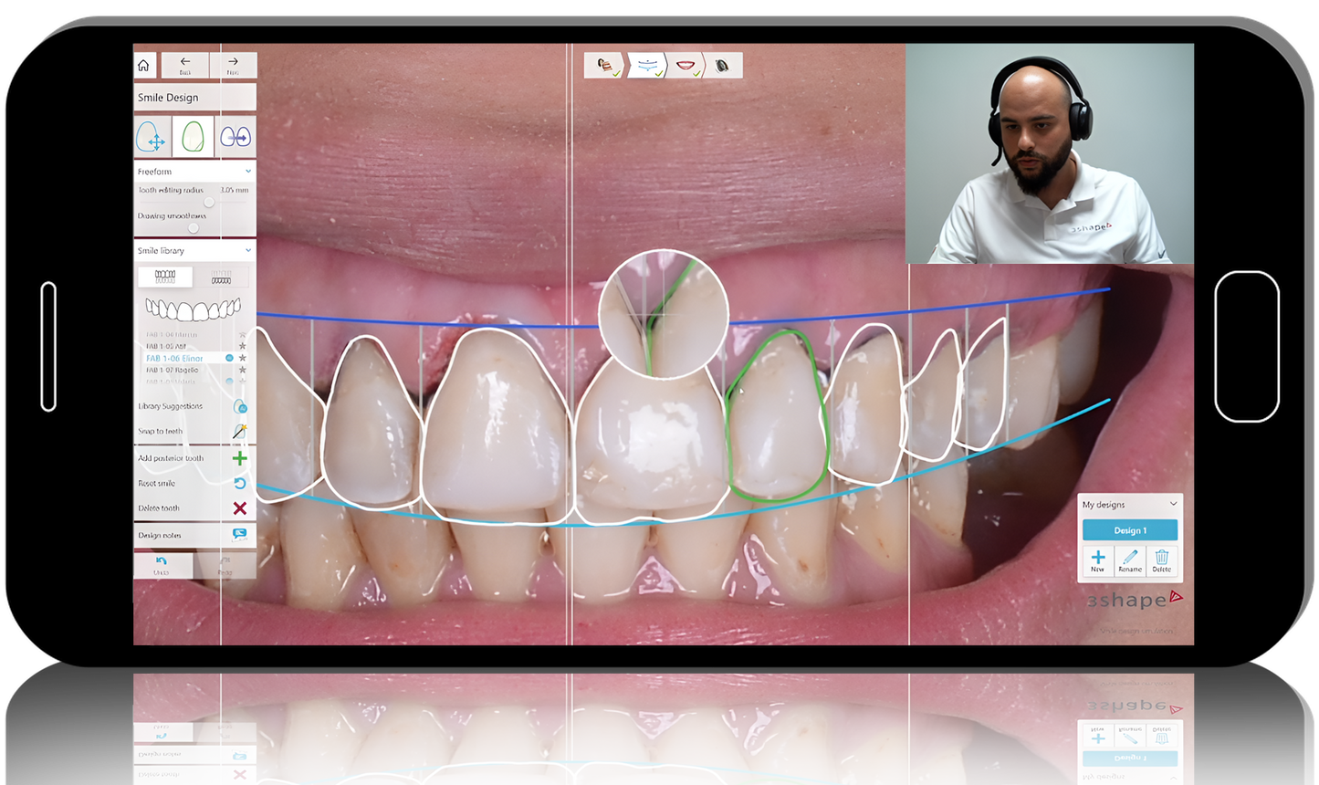 3Shape Practical Guide for Prosthodontists and Technicians