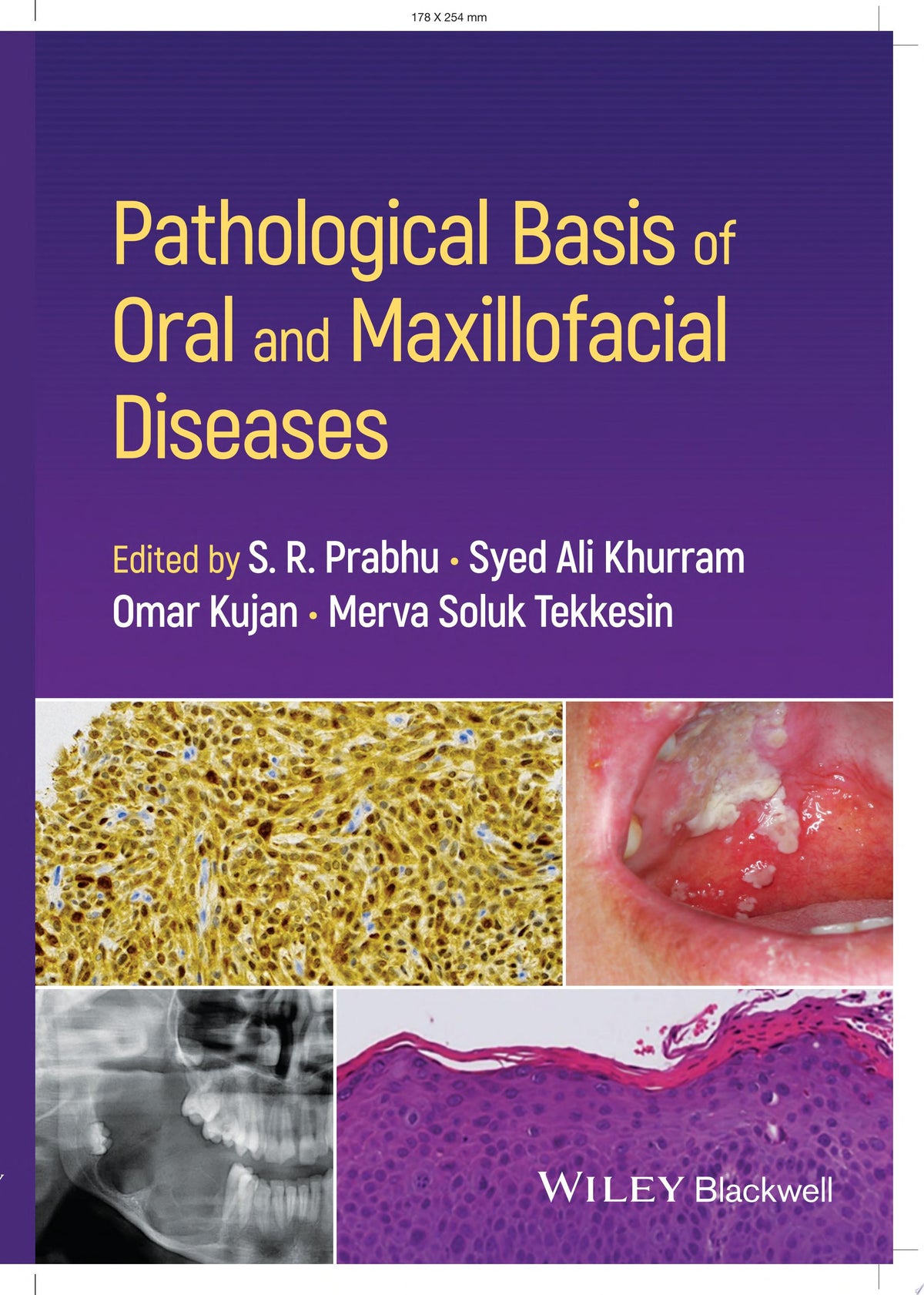 Pathological Basis of Oral and Maxillofacial Diseases