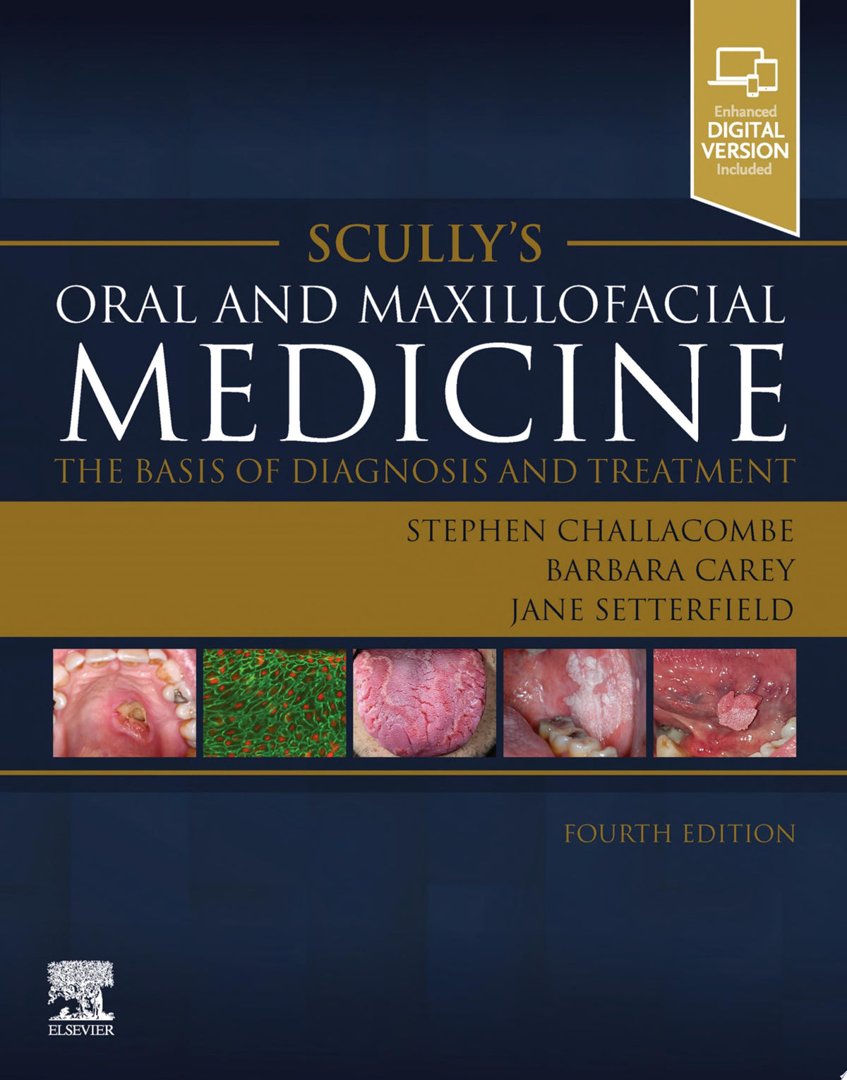 Scully's Oral and Maxillofacial Medicine: The Basis of Diagnosis and Treatment - E-Book