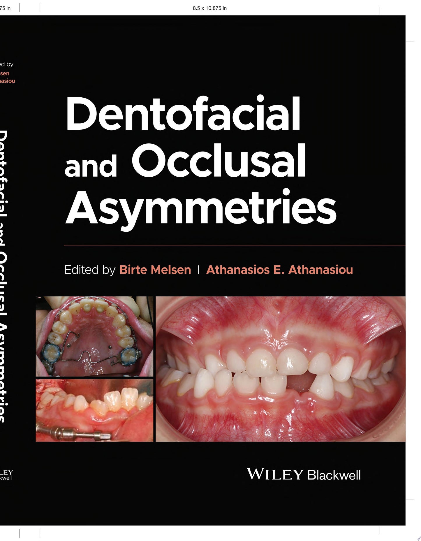 Dentofacial and Occlusal Asymmetries