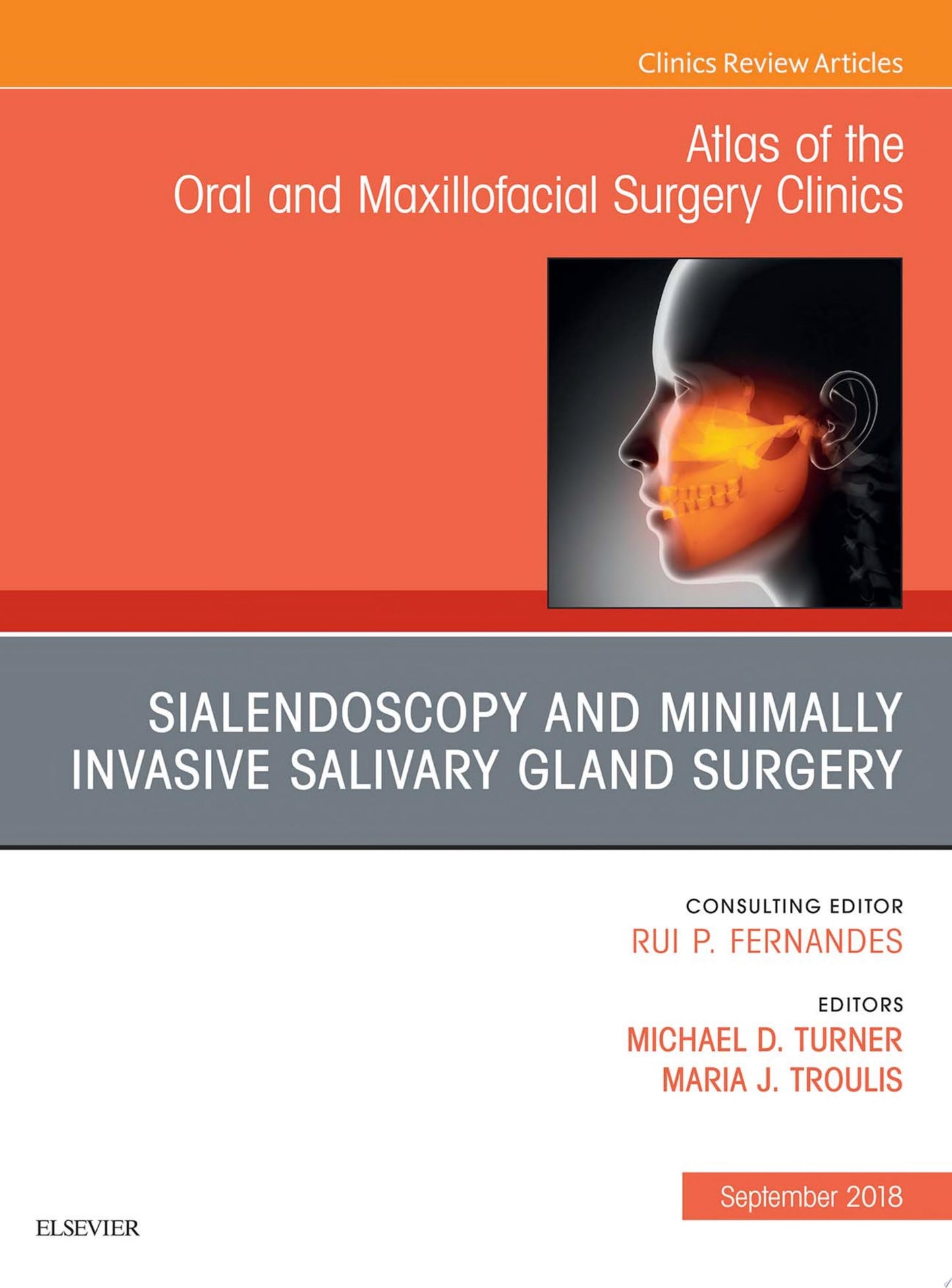 Sialendoscopy, An Issue of Atlas of the Oral & Maxillofacial Surgery Clinics