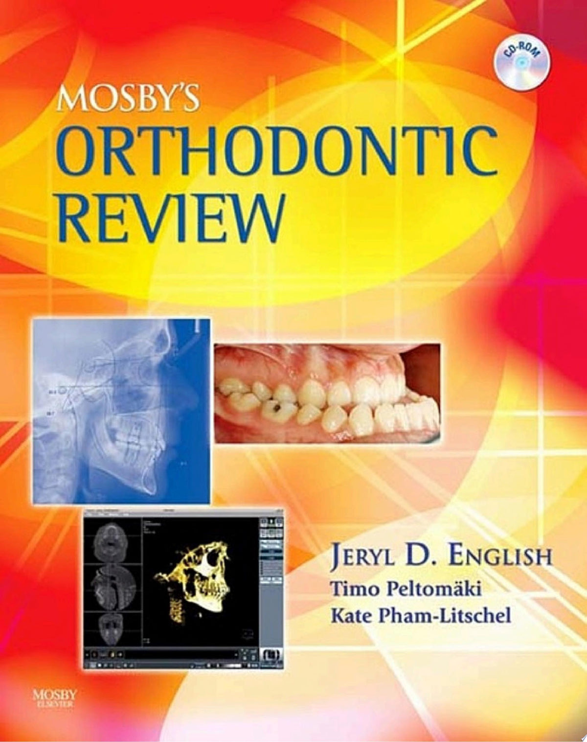 Mosby's Orthodontic Review - E-Book