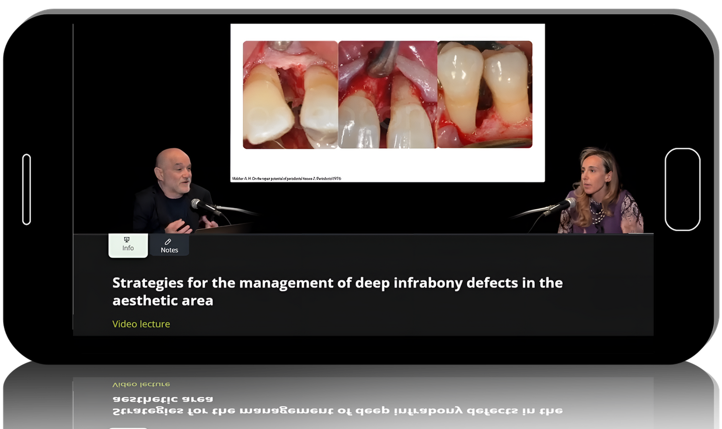 Periodontal Regenerative Surgical Approach