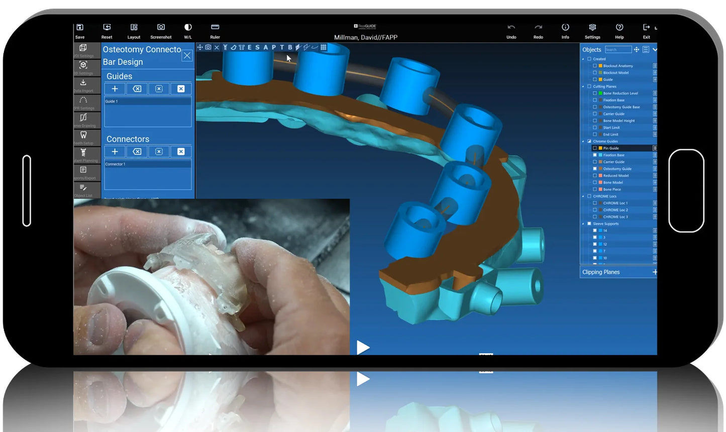 GuidedSMILE Design Certification Course: 101