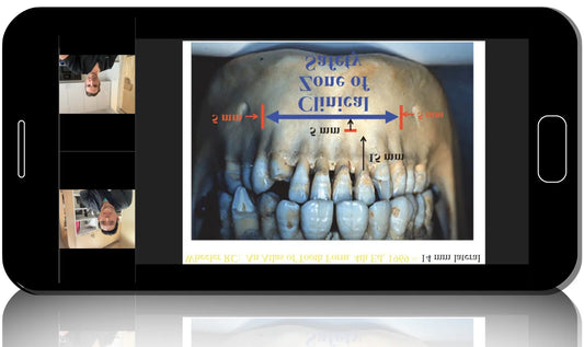 The Complete Digital Implant Workflow Series