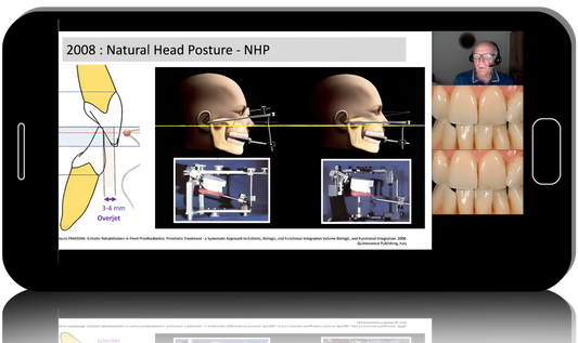 Removable complete dentures and Digital Dentures