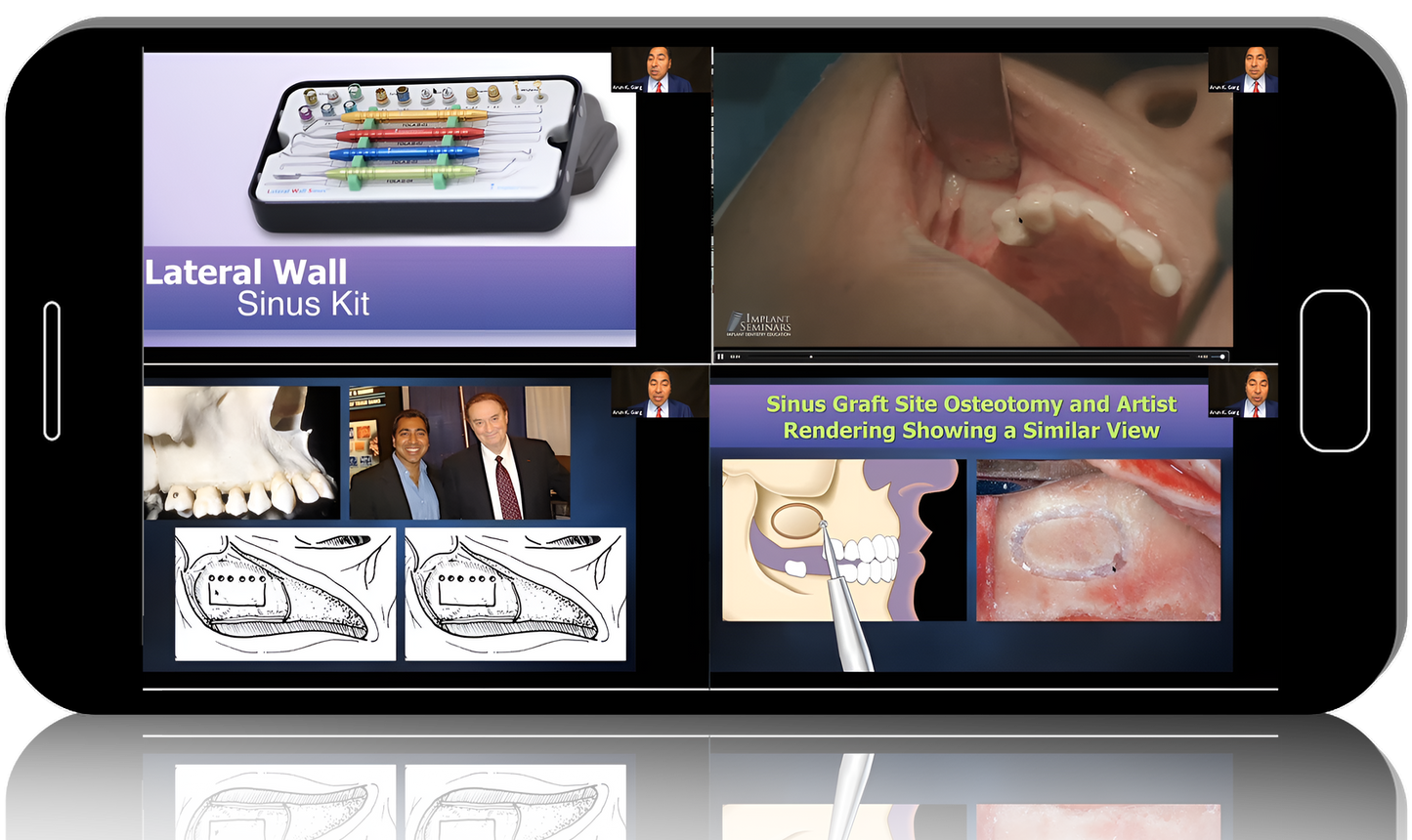 Dental Implants MasterClass: Tipton Training