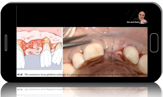 Quintessence Publishing Dr. Kris Chmelewski Webinars