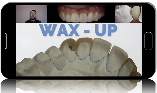 Injectable Technique: Composites Veneers, Comprehensive Online MasterClass 2022