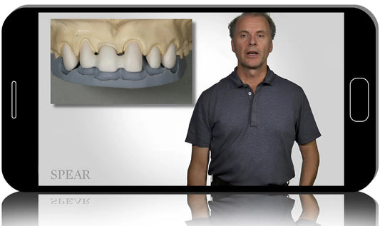 Digital Dentistry: From Polishing to Thermoplastics