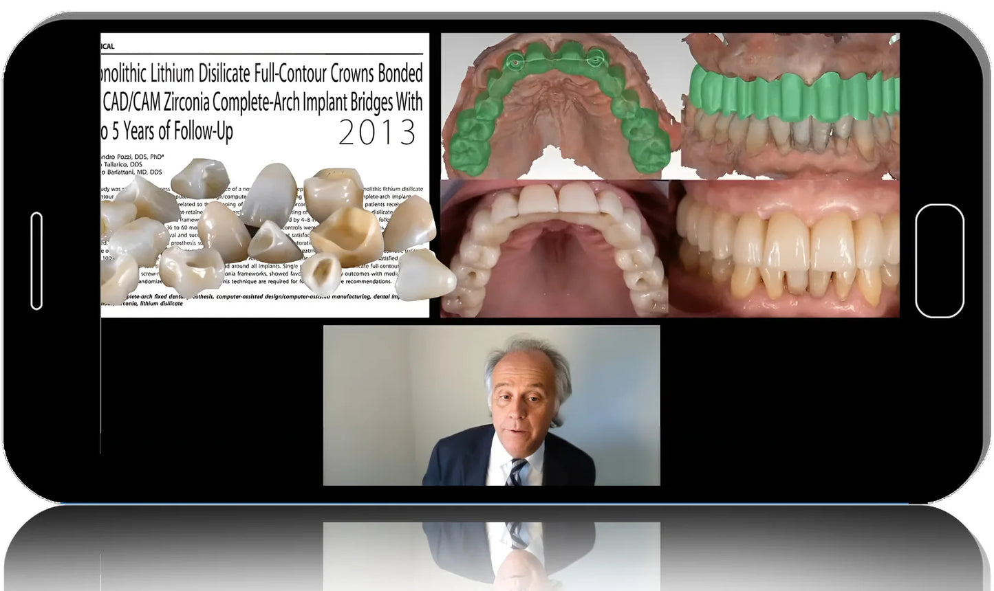 Orchestration of DTX Software: Static Guided Surgery