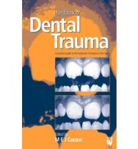 Handbook of Dental Trauma: A Practical Guide to the Treatment of Trauma to the Teeth