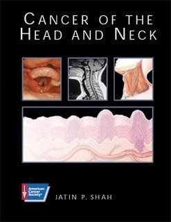 Atlas of Clinical Oncology: Cancer of the Head and Neck (American Cancer Society)