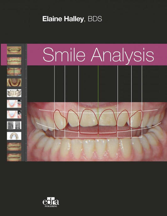 SMILE ANALYSIS (Elaine Halley)