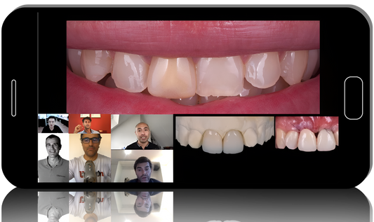 Implant Complications in the Aesthetic Zone