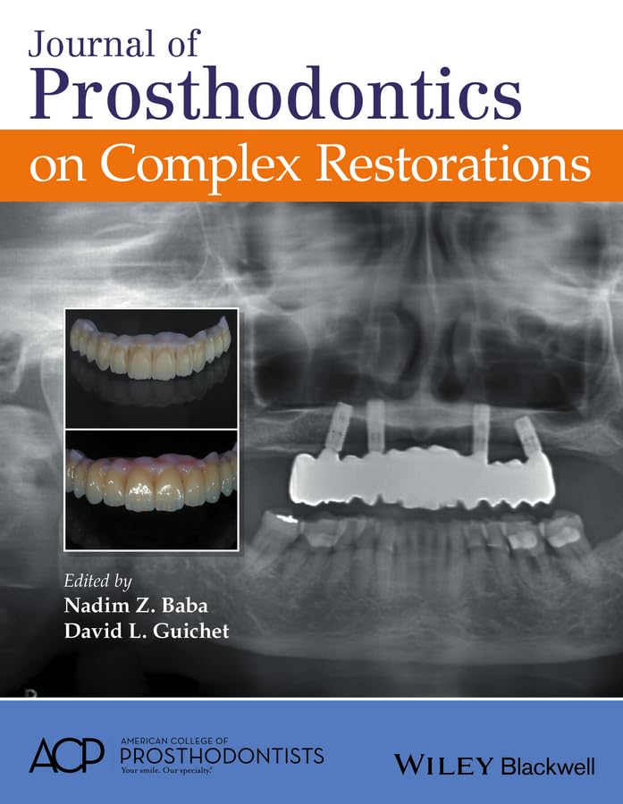 Journal of Prosthodontics on Complex Restorations 1st Edition