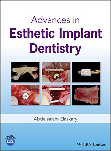 Advances in Esthetic Implant Dentistry 1st Edition